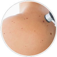 Skin Conditions
