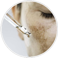 Pigmentation & spots